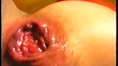 Excellent vintage anal prolapse