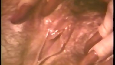 softcore clip 19
